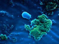 1. Teil der Rundschau Serie Antibiotika - Resistenz gegen Antibiotika